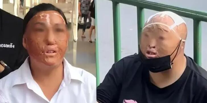 曼谷出现多名中国籍毁容乞讨者